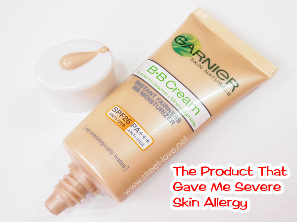 Skin Allergy1