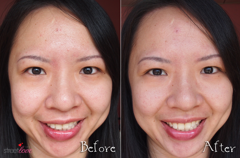Clarins 4th Generation Shaping Facial Lift Before and After