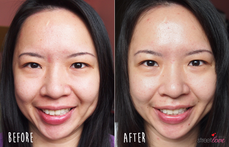 Black Silica Salt Before and After Full Face