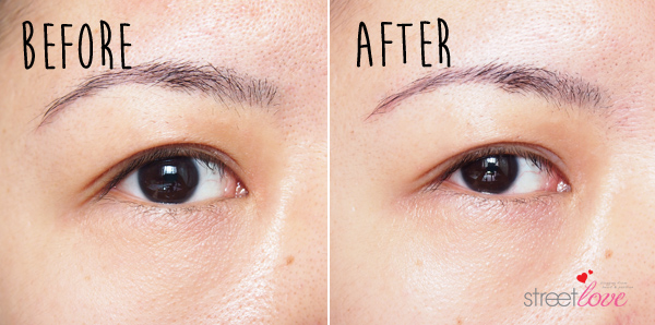 SK-II Magnetic Eye Care Kit Before and After Right