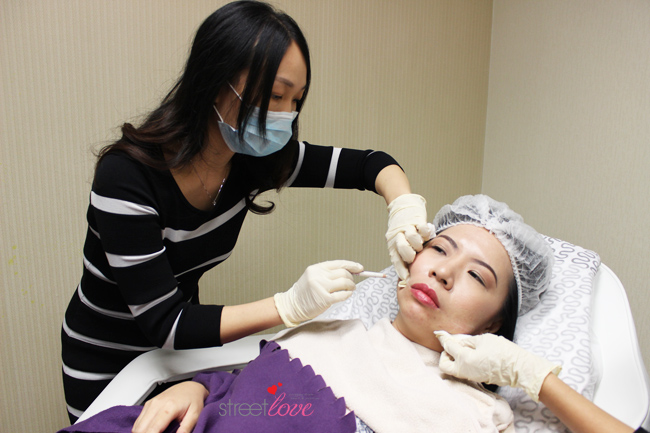 Premier Clinic Botox Facial Sculpting Mapping 3